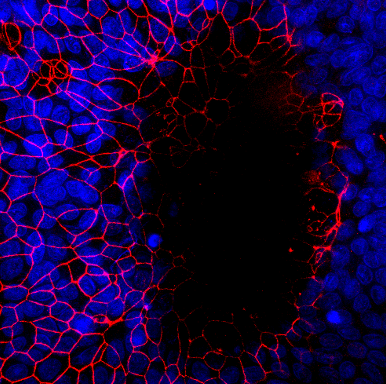 Immunofluorescent image of a large intestinal organoid-derived monolayer infected  with E. histolytica trophozoites