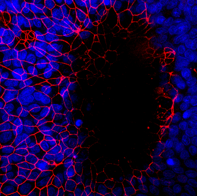 Immunofluorescent image of a large intestinal organoid-derived monolayer infected with E. histolytica trophozoites Immunofluorescent image of a large intestinal organoid-derived monolayer infected with E. histolytica trophozoites