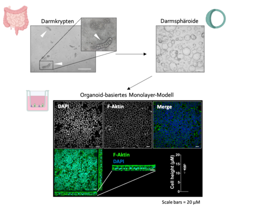 Die Grafik zeigt, wie man von Darmkrypten über Damsphäroide zu einem Organoidmodell kommt.