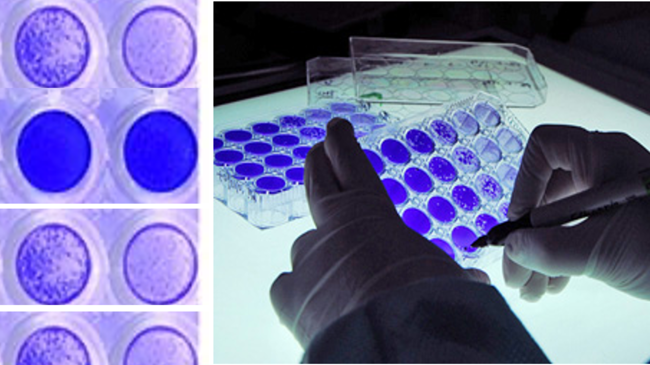 Ein Plaque Assay: zu sehen sind mehrere Wells, die mittels eines Plaque Assays angefärbt wurden und unterschiedlich stark blau eingefärbt sind. Rechts sieht man, wie eine Person das Plaque Assay auszählt, hierzu wird mit einem Stift ein Plaque markiert.