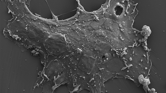 Das elektronenmikroskopische Bild zeigt ein Nipah-Virus. Es erinner an Astrozytom, mit seinen nach mehreren Seiten hin ausgreifenden Armen.