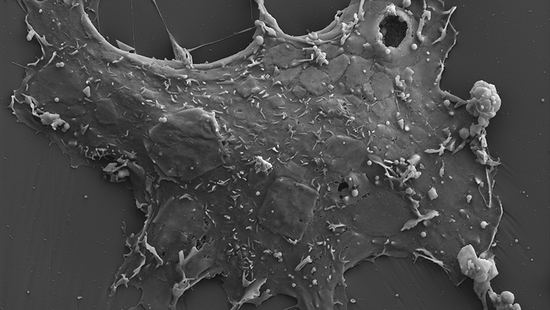 The electron micrograph shows a Nipah virus. It is reminiscent of an astrocytoma, with its arms extending in several directions.