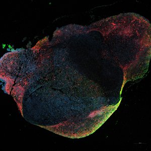 Das Foto zeigt eine Fluoreszenzaufnahme von einem Hirnorganoid, das mit dem Ebola-Virus infiziert ist. Das Organoid ist in verschiedenen Farben angefärbt, das Ebola-Virus leuchtet grün, Nervenzellen rot und Zellkerne blau..