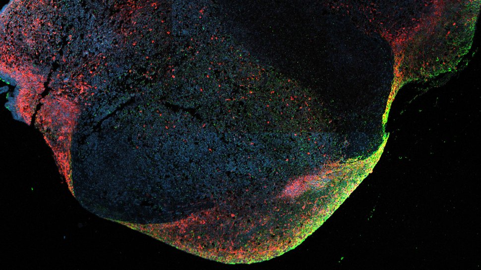 Hirnorganoid Das Foto zeigt eine Fluoreszenzaufnahme von einem Hirnorganoid, das mit dem Ebola-Virus infiziert ist. Das Organoid ist in verschiedenen Farben angefärbt, das Ebola-Virus leuchtet grün, Nervenzellen rot und Zellkerne blau..