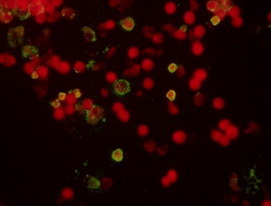 Rickettsia diagnostics - Indirect immunofluorescence Rickettsia diagnostics - Indirect immunofluorescence of the blood. Several red circles on a black background can be seen. Some of the red spheres have a green glowing veil around the outer area.