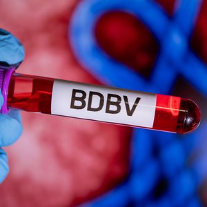Bundibugyo-Virus-Ausbruch in der Demokratischen Republik Kongo Das Foto zeigt eine Hand mit blauen Laborhandschuhen, die ein Probenröhrchen mit der Aufschrift BDBV hält. Im Hintergrund eine blau-rot gefärbte elektronenmikroskopische Aufnahme von Ebola-Viren.