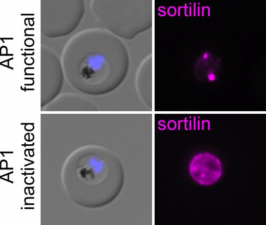 Links: Zwei lichtmikroskopische Aufnahmen von Malariaparasiten in roten Blutkörperchen. Rechts die zugehörigen magentafarbenen Fluoreszenzfärbungen des Proteins Sortilin des Malariaparasiten auf schwarzen Hintergrund.