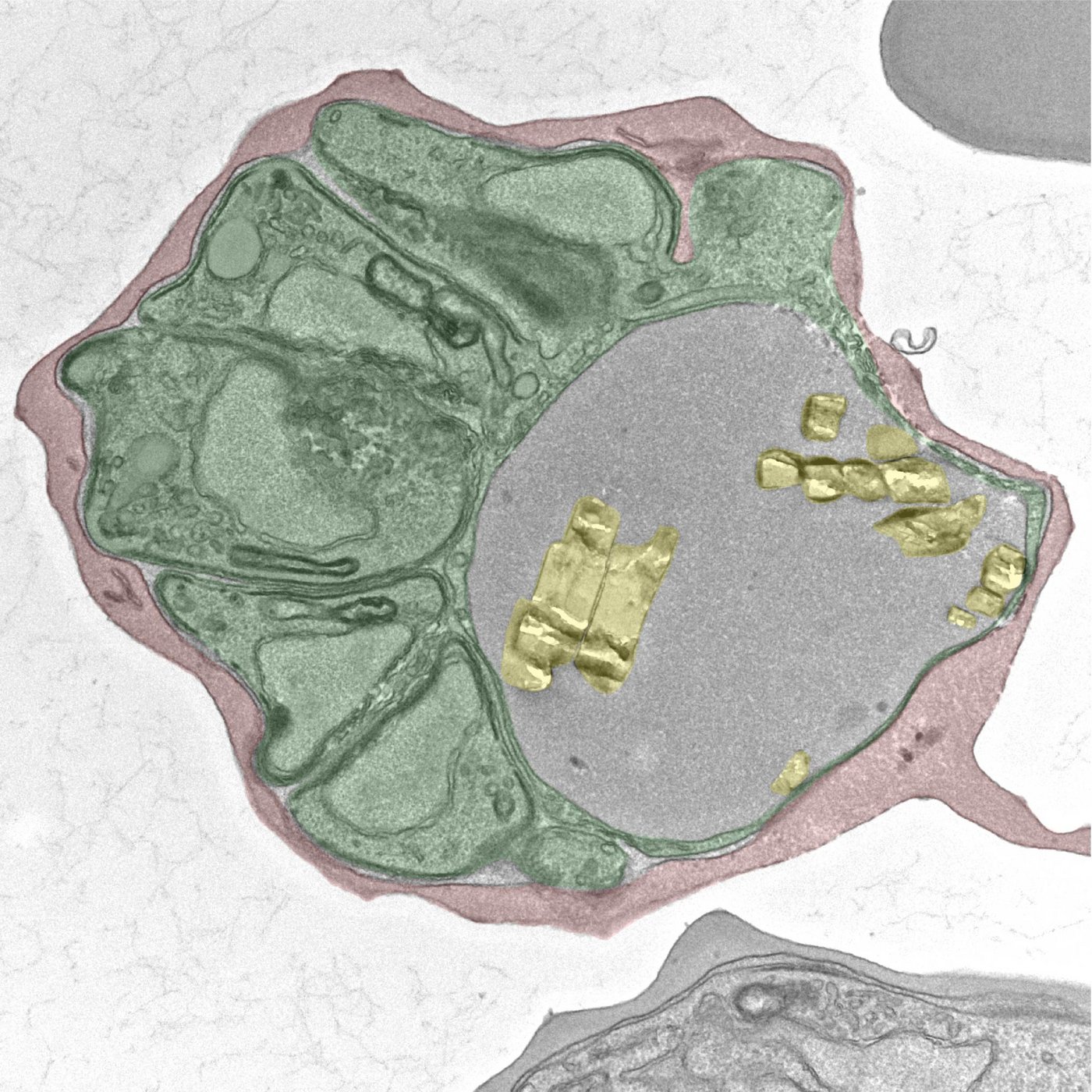 Image shows a pseudo-colorized transmission electron microscopy image of a Plasmodium falciparum-infected red blood cell