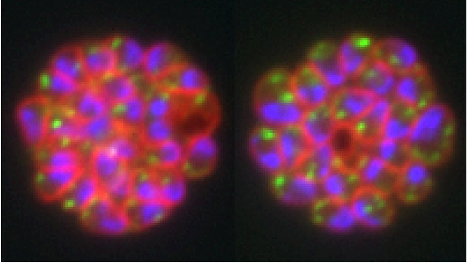 Staining of the malaria parasite Two fluorescence images in magenta, green and blue of the malaria parasite