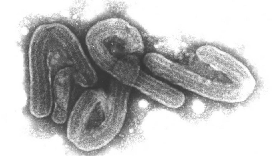 Electron microscopic image of Marburg viruses
