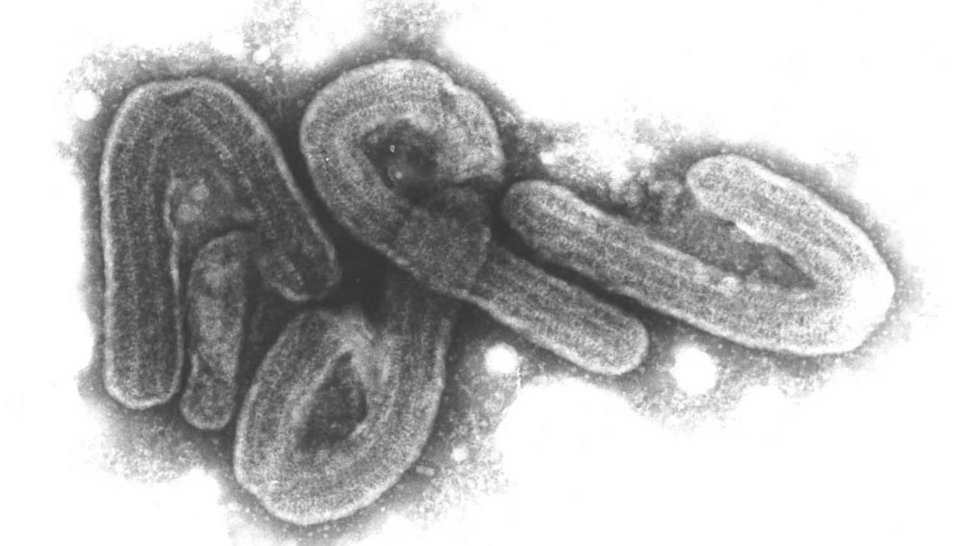 Elektronenmikroskopisches Schwarz-Weiß-Bild von Marburg-Viren