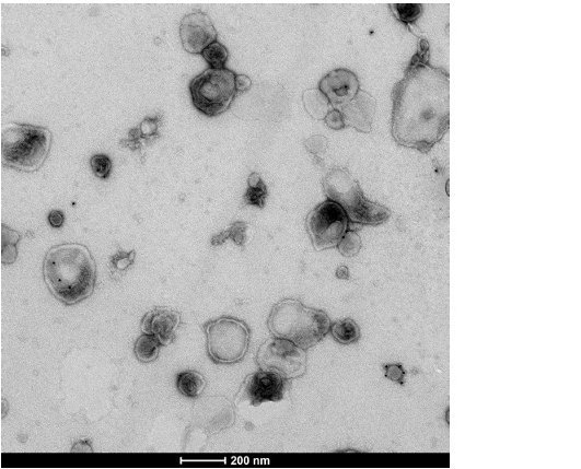 TEM shows EVs derived from human lung endothelial cells