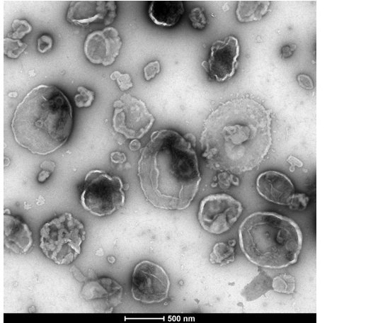 TEM shows EVs derived from human brain endothelial cells TEM shows EVs derived from human brain endothelial cells