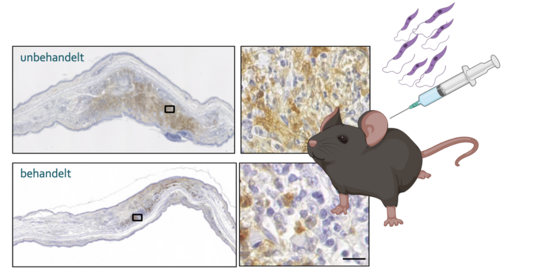 Die Fotos zeigen mikroskopische Aufnahmen von Hautläsionen.