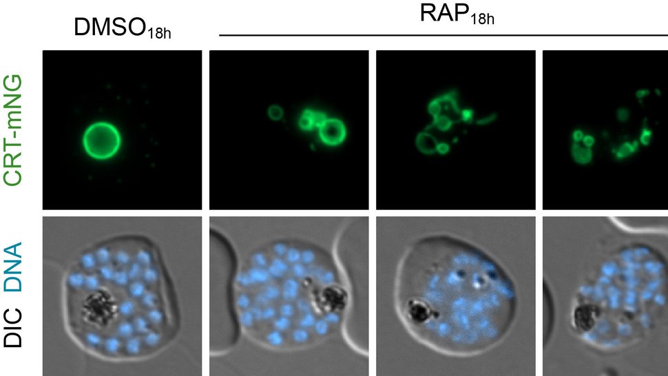 The graphic consists of an upper row of four electron microscope images and a lower row. On the far left is the healthy parasite, the three on the right show the disintegrated vacuole because the membrane-associated part of the proton pump is inhibited.