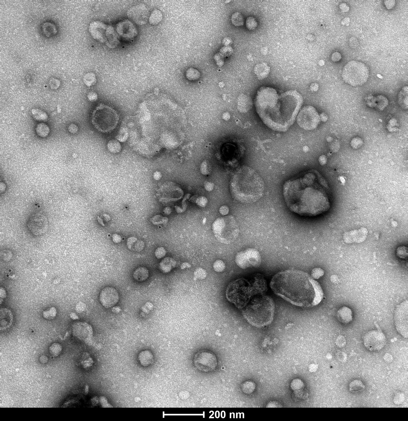 Zu sehen ist eine Transmissionselektronenmikroskopie von extrazellulären Vesikeln der Amöben: ein Bild in grauen Tönen gehaltet zeigt unterschiedlich große und willkürlich über das Bild verteilte unregelmäßige Kreise. Am unteren Rand steht auf einem schwarzen Balken ein Pfeil mit der Größeneinheit 200nm.