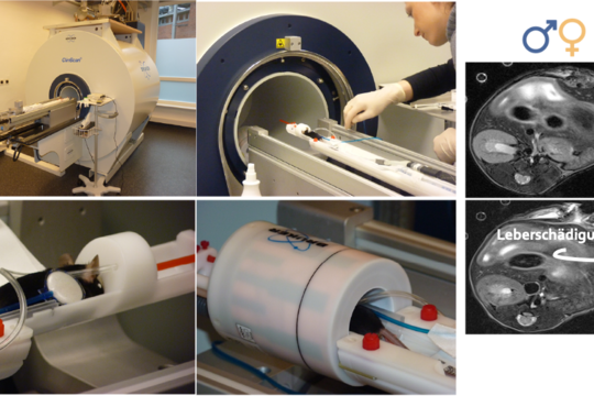 Diese Fotocollage zeigt einen Magnetresonanztomographen, in den eine Maus geschoben wird. Zudem sind zwei Magnetresonanzbilder von der Leber (männlich sowie weiblich) zu sehen.
