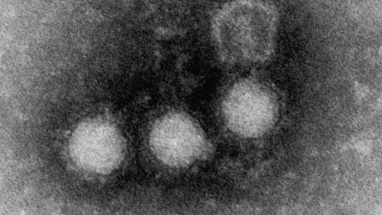 Electron microscope image of Chikungunya viruses Electron microscope image of Chikungunya viruses
