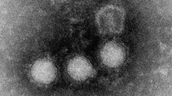 Elektronenmikroskopisches Bild von Chikungunya-Viren Elektronenmikroskopisches Bild von Chikungunya-Viren