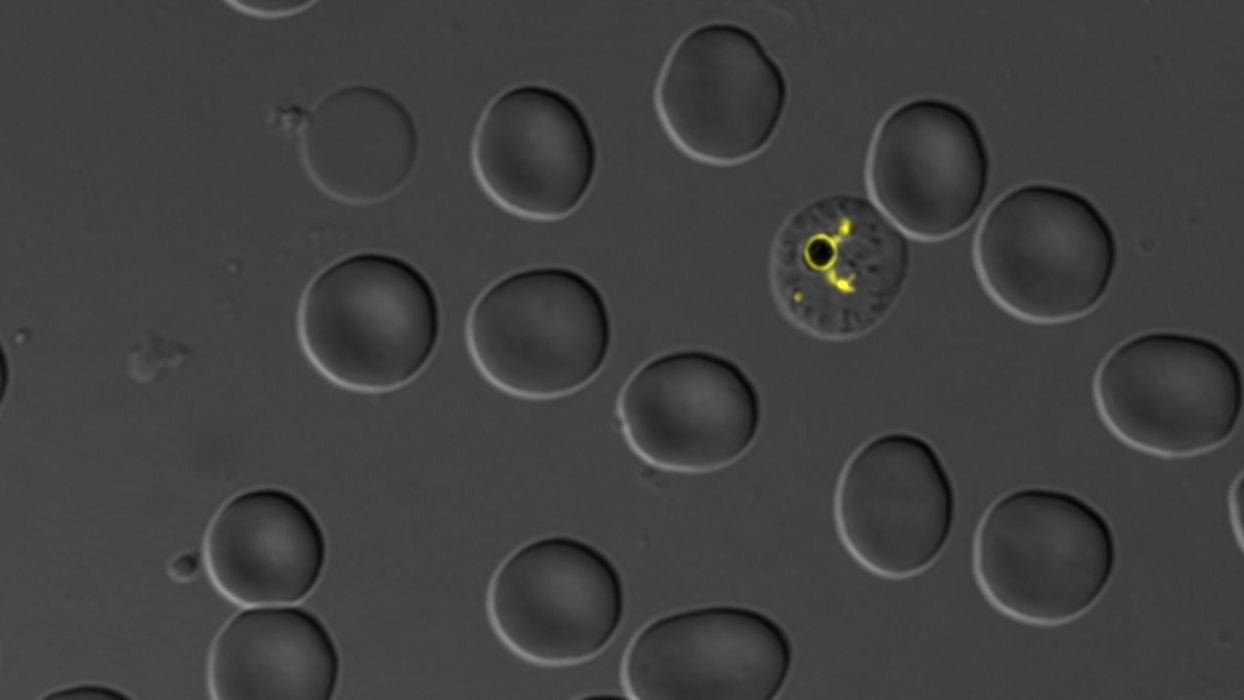 Image shows an electron microscopy image