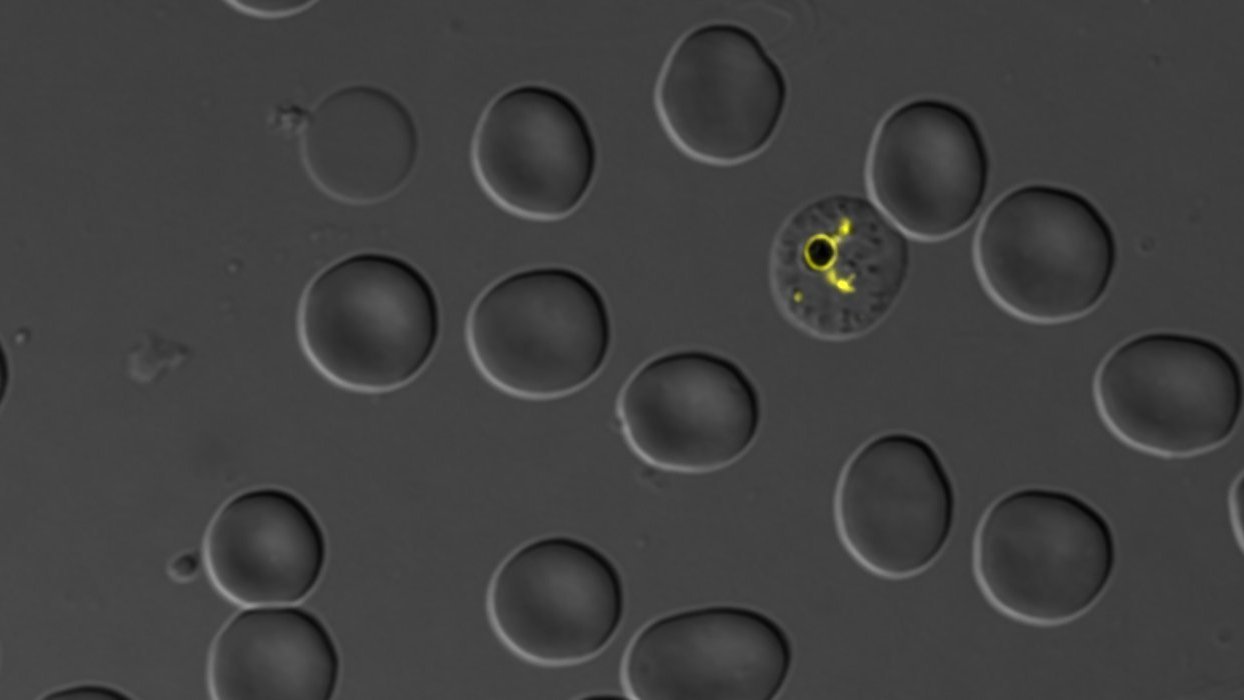 Plasmodium falciparum parasite and its digestive vacuole (yellow)