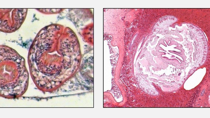 Pathogen detection in tissue: Microscopically visible parasite (components) [left: Head anlagen of the three-limbed dog tapeworm (Echninococcus granulosus); middle: Tongue worm (Armillifer armillatus) cross-section; right: nematode (Halicephalobus) in the brain].