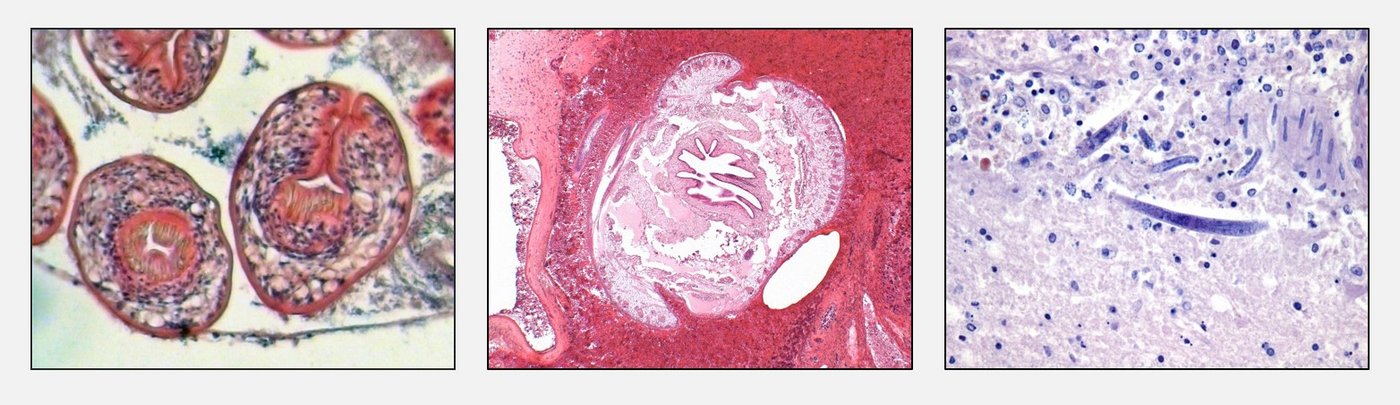 Erregernachweis im Gewebe: Mikroskopisch sichtbare Parasiten(bestandteile)  [links: Kopfanlagen des dreigliedrigen Hundebandwurms (Echninococcus granulosus);  Mitte: Zungenwurm (Armillifer armillatus) Querschnitt;  rechts: Fadenwurm (Halicephalobus) im Gehirn]