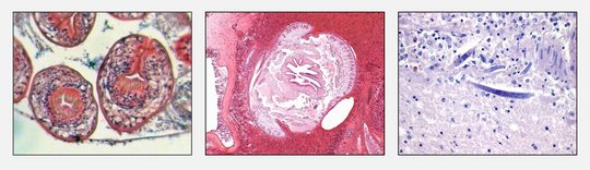 Erregernachweis im Gewebe: Mikroskopisch sichtbare Parasiten(bestandteile)  [links: Kopfanlagen des dreigliedrigen Hundebandwurms (Echninococcus granulosus);  mitte: Zungenwurm (Armillifer armillatus) Querschnitt;  rechts: Fadenwurm (Halicephalobus) im Gehirn]