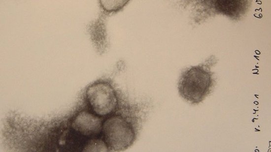 Link to the FAQ on Smallpox viruses