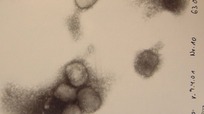 Zu sehen ist eine mikroskopische Aufnahme von Affenpocken. im unteren Bereich des Bildes sieht man eine Anhäufung von vier, rundlich, grau-schwarzen Viren,