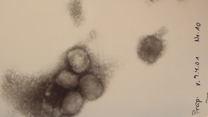A microscopic image of monkeypox is shown. In the lower part of the image, you can see an accumulation of four, roundish, grey-black viruses,
