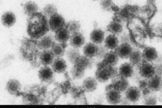 Elektronenmikroskopische Aufnahme von Zellen, die mit dem Sindbis-Virus infiziert sind Elektronenmikroskopische Aufnahme von kugelförmigen Viruspartikeln, die dicht beieinander liegen