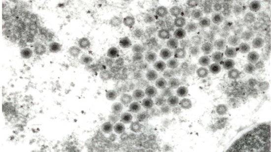 Elektronenmikroskopisches Bild von Hanta-Viren Elektronenmikroskopisches Bild von Hanta-Viren