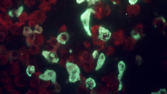 Fluoreszenzmikroskopische Aufnahme von Zellen, die mit dem Sindbis-Virus infiziert sind Fluoreszenzmikroskopische Aufnahme von Zellen mit roten und grünen fluoreszierenden Bereichen auf dunklem Hintergrund