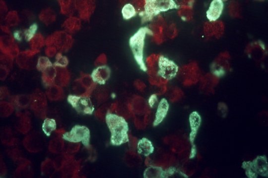 Fluoreszenzmikroskopische Aufnahme von Zellen, die mit dem Sindbis-Virus infiziert sind Fluoreszenzmikroskopische Aufnahme von Zellen mit roten und grünen fluoreszierenden Bereichen auf dunklem Hintergrund