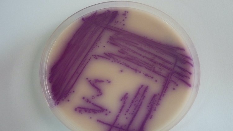 Salmonella enterica on chromeagar Zu sehen ist eine Petrischalfe in denen die Erreger sich Lila absetzen