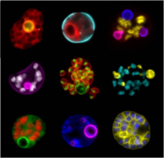 Das Bild zeigt eine elektronenmikroskopische Aufnahme von Malaria-Parasiten.