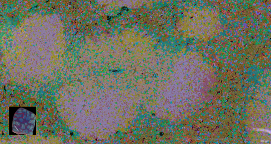 Eine Darstellung der Milz einer Maus mit bunten Punkten, die verschiedene Zellarten markieren