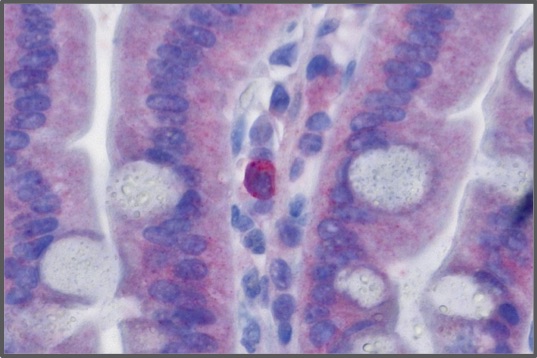 Das Bild zeigt einen eingefärbten Gewebeschnitt von Darmgewebe.