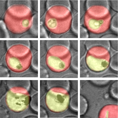 Abgebildet sind sieben mikroskopische Aufnahmen von Blutzellen mit Malariaparasiten, die über die Zeit (30 Stunden) fotografiert wurden.
