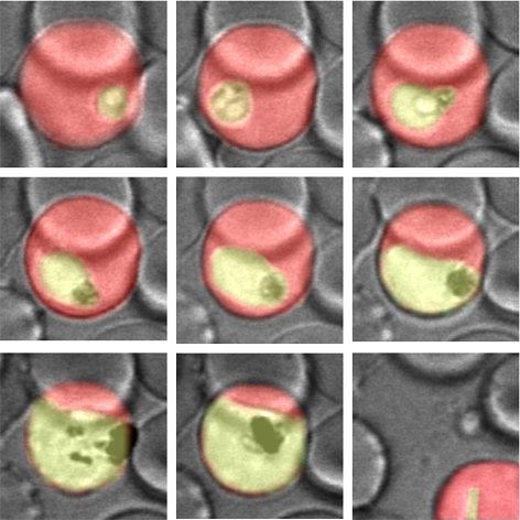 Shown are seven microscopic images of blood cells with malaria parasites photographed over time (30 hours).