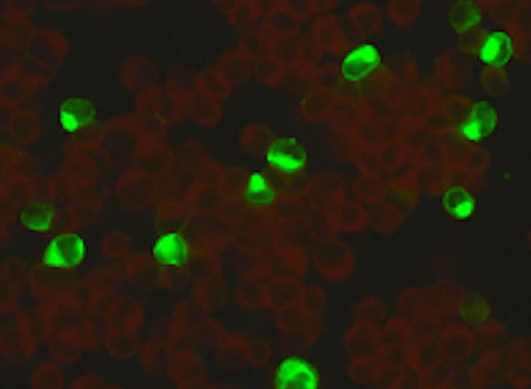 Aufnahme des Zikavirus. Befallene Zellen leuchten grün.