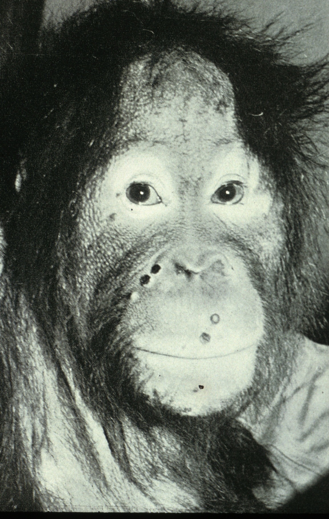 Black and white picture of an Orang-Utan with Mpox