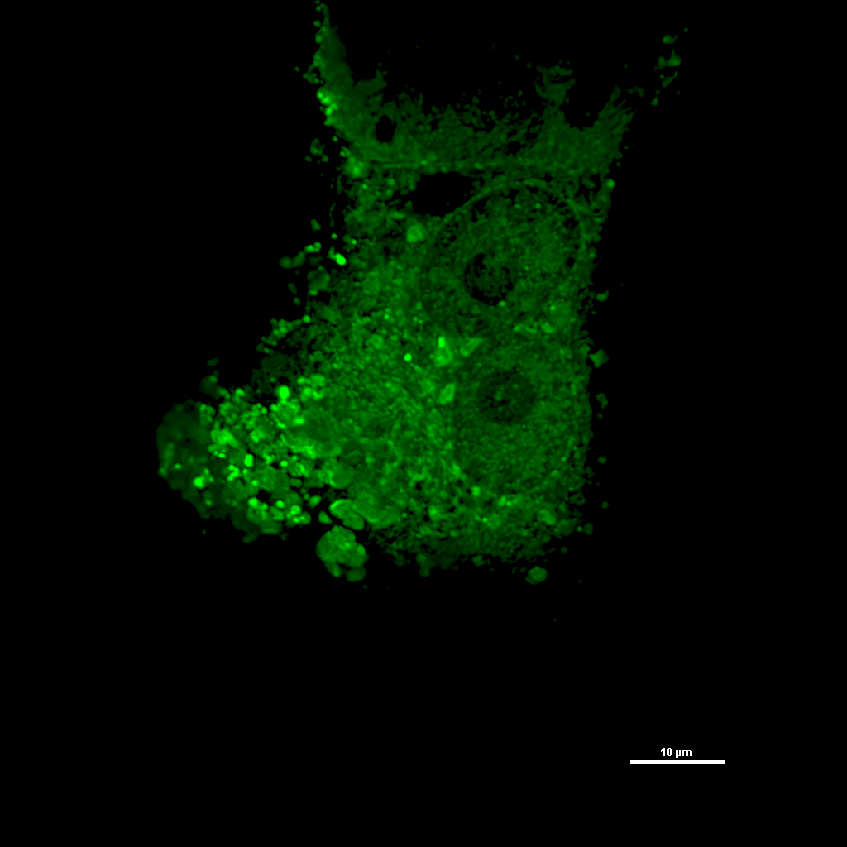 Fluorescence microscope image of Nipah viruses Fluorescence microscope image of greenish glowing Nipah viruses