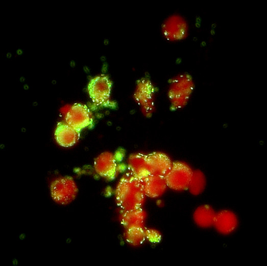 Rickettsien-Immunfluoreszenz Aufnahme Rickettsien mit Immunfluoreszenz. Diese leuchtet grün.