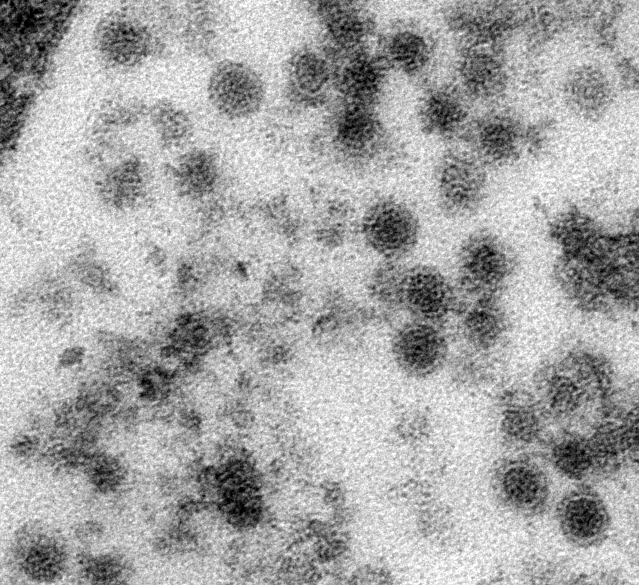 Aufnahme von Usutuviren unter dem Elektronenmikroskop
