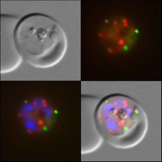 Das Bild zeigt eine 1000fache Vergrößerung eines Malariaparasiten in einer menschlichen Zelle