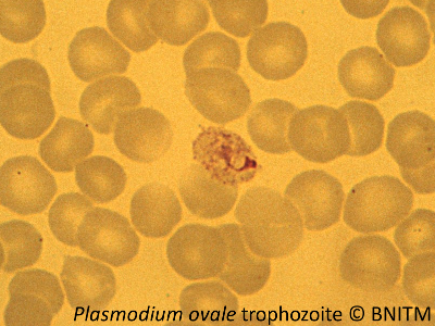 Das Bild zeigt eine mikroskopische Ansicht von Plasmoidien