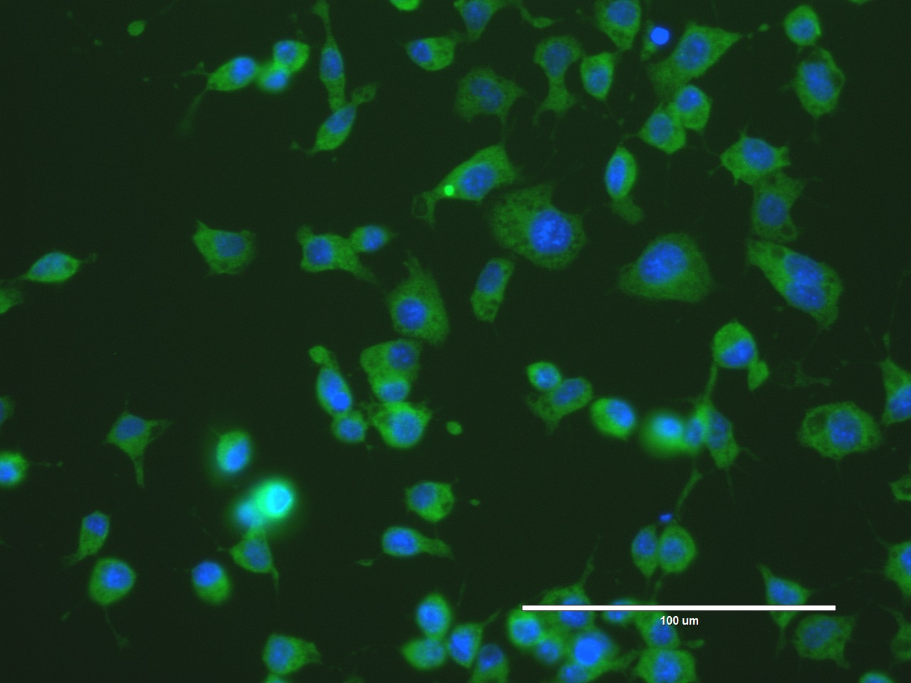 Fluoreszenz-mikroskopisches Bild mit ASALV-infizierten Mückenzellen