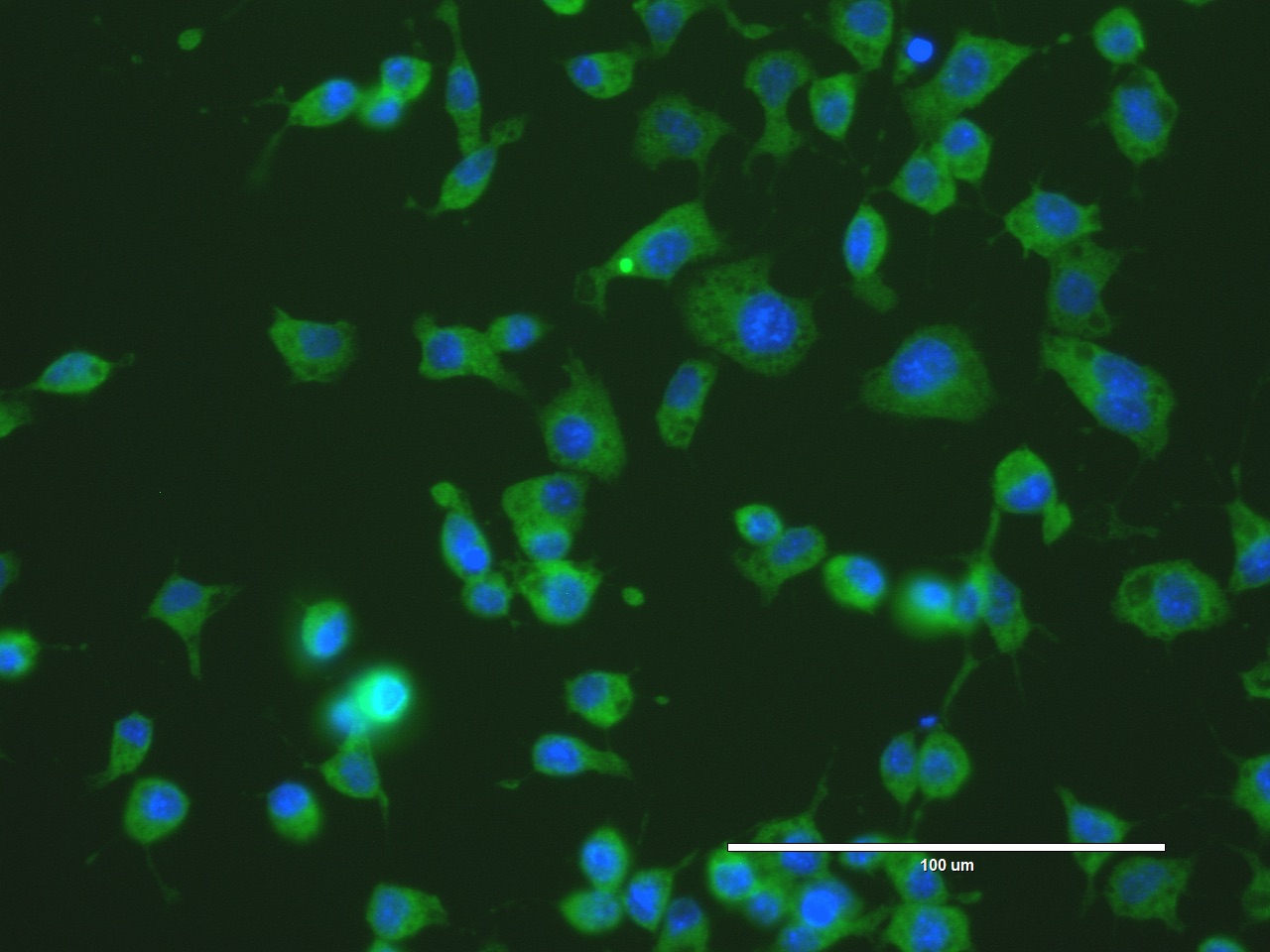 Fluorescent microscopic image of ASALV infected mosquito cells